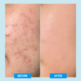 Mandelica Gentle Cleanser