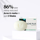 Acne Plus Bar