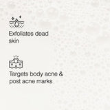Acne Plus Bar