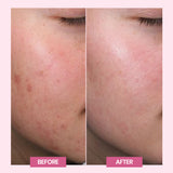 Acne Plus Face Wash
