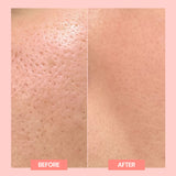 N Sinamide Serum